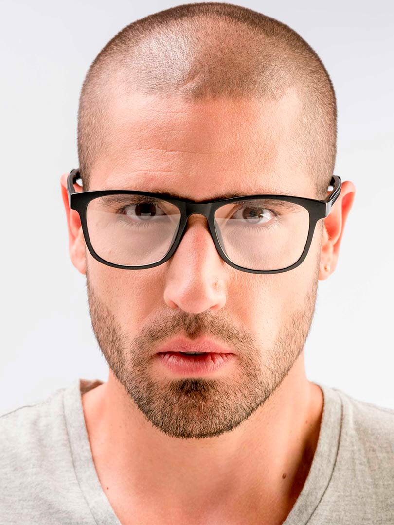 Dynamic Amarillas 6 en 1 Colorlens® (7464118976734)